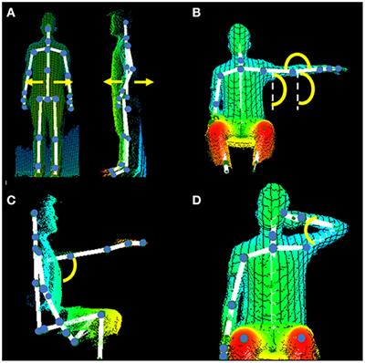 A New Software for Quantifying Motor Deficit After Stroke: A Case–Control Feasibility Pilot Study